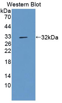 Polyclonal Antibody to Fucose-1-Phosphate Guanylyltransferase (FPGT)