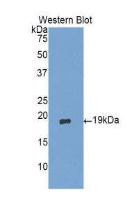 Polyclonal Antibody to Gastrokine 1 (GKN1)