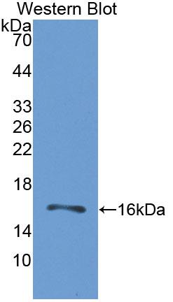 Polyclonal Antibody to Gastrin Releasing Peptide Receptor (GRPR)