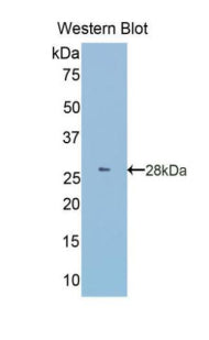 Polyclonal Antibody to Granulin (GRN)