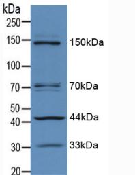 Polyclonal Antibody to Insulin Receptor Substrate 1 (IRS1)