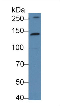 Polyclonal Antibody to Kinectin 1 (KTN1)