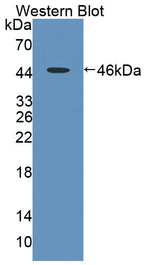 Polyclonal Antibody to Ladinin 1 (LAD1)