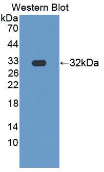 Polyclonal Antibody to Leucine Rich Repeats And Death Domain Containing Protein (LRDD)