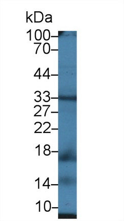 Polyclonal Antibody to Mitochondrial Uncoupling Protein 2 (UCP2)