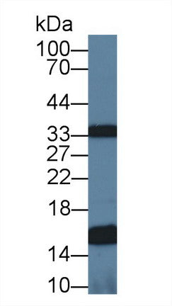 Polyclonal Antibody to Ubiquinol Cytochrome C Reductase Binding Protein (UQCRB)