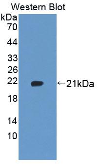 Polyclonal Antibody to Ubiquitously Expressed Transcript (UXT)