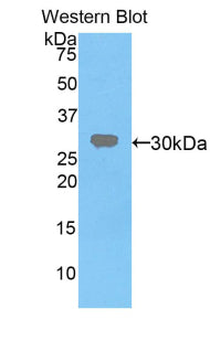 Polyclonal Antibody to Vaccinia Related Kinase 1 (VRK1)