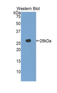 Polyclonal Antibody to 3-Mercaptopyruvate Sulfurtransferase (MST)