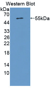 Polyclonal Antibody to Metastasis Associated Protein 1 (MTA1)