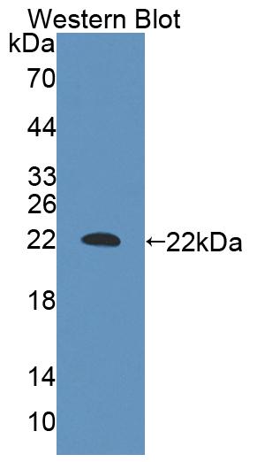 Polyclonal Antibody to Nuclear Factor I/A (NFIA)