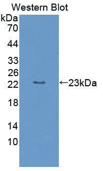 Polyclonal Antibody to Optic Atrophy 3 (OPA3)