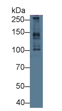 Polyclonal Antibody to Pericentriolar Material 1 (PCM1)