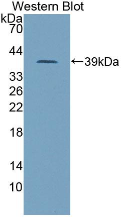 Polyclonal Antibody to Phosphatidylinositol Transfer Protein Beta (PITPNb)