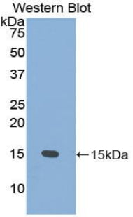 Polyclonal Antibody to Prostate Stem Cell Antigen (PSCA)