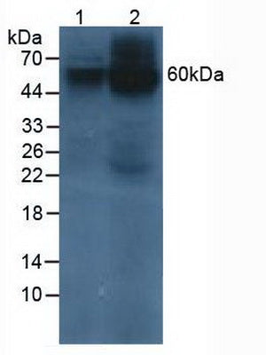 Polyclonal Antibody to Prosaposin (PSAP)