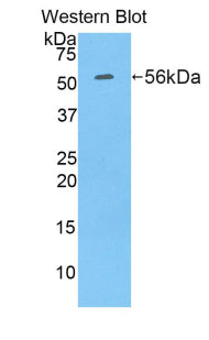 Polyclonal Antibody to Ribophorin I (RPN1)