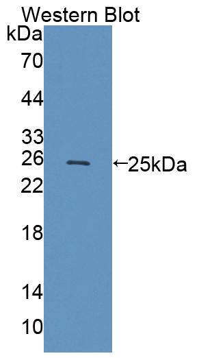 Polyclonal Antibody to Threonine Aspartase 1 (TASP1)