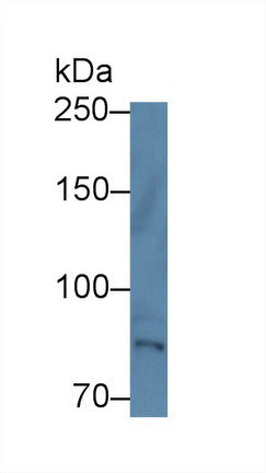 Polyclonal Antibody to Tec Protein Tyrosine Kinase (TEC)