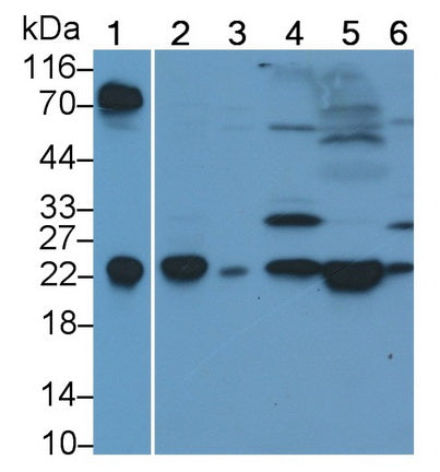 Polyclonal Antibody to Thymocyte Nuclear Protein 1 (THYN1)