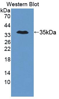 Polyclonal Antibody to Trinucleotide Repeat Containing Protein 6A (TNRC6A)