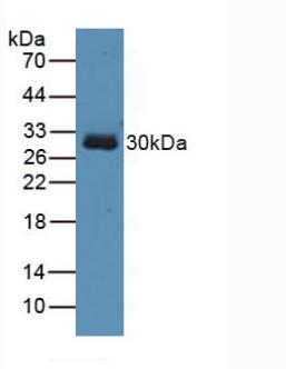 Polyclonal Antibody to Toll Interacting Protein (TOLLIP)