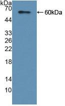 Polyclonal Antibody to Adenylyl Cyclase Associated Protein 2 (CAP2)