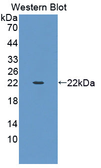 Polyclonal Antibody to Smoothelin (SMTN)