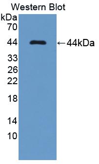 Polyclonal Antibody to Deoxyhypusine Synthase (DHPS)