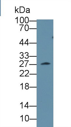 Polyclonal Antibody to Clathrin, Light Polypeptide A (CLTA)