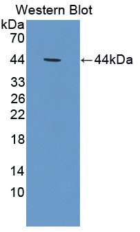 Polyclonal Antibody to Calpain 10 (CAPN10)