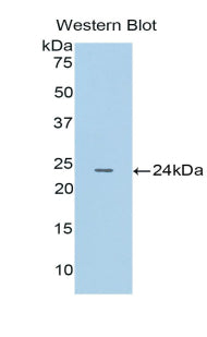 Polyclonal Antibody to Cathepsin B (CTSB)