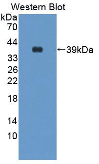 Polyclonal Antibody to Cathepsin H (CTSH)