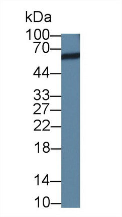 Polyclonal Antibody to Asparaginyl tRNA Synthetase (NARS)