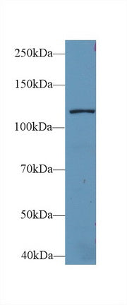 Polyclonal Antibody to Leucyl tRNA Synthetase (LARS)