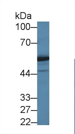 Polyclonal Antibody to Aspartyl tRNA Synthetase (DARS)