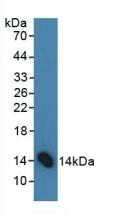 Polyclonal Antibody to Follicle Stimulating Hormone Beta (FSHb)