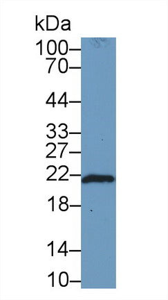 Polyclonal Antibody to Ferritin, Heavy Polypeptide (FTH)