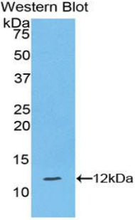 Polyclonal Antibody to Heat Shock 70kDa Protein 2 (HSPA2)
