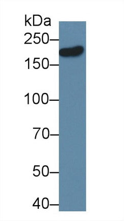 Polyclonal Antibody to Discs, Large Homolog 5 (DLG5)