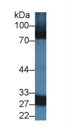 Polyclonal Antibody to Carbonic Anhydrase VA (CA5A)