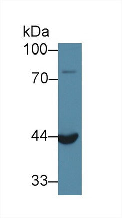 Polyclonal Antibody to Acid Phosphatase 6, Lysophosphatidic (ACP6)