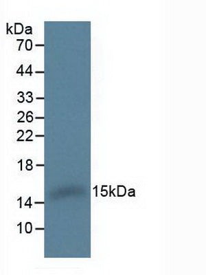 Polyclonal Antibody to Hemoglobin Alpha 1 (HBa1)