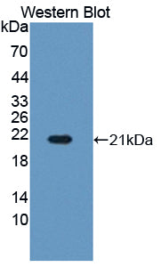 Polyclonal Antibody to Hemoglobin Beta (HBb)