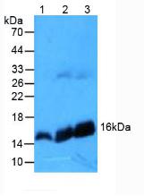 Polyclonal Antibody to Hemoglobin Beta (HBb)