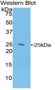Polyclonal Antibody to Hemoglobin Beta (HBb)