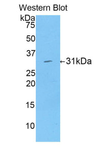 Polyclonal Antibody to Low Density Lipoprotein Receptor Related Protein Associated Protein 1 (LRPAP1)