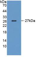 Polyclonal Antibody to Low Density Lipoprotein Receptor Related Protein 1B (LRP1B)