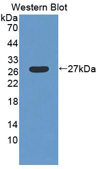 Polyclonal Antibody to Low Density Lipoprotein Receptor Related Protein 1B (LRP1B)