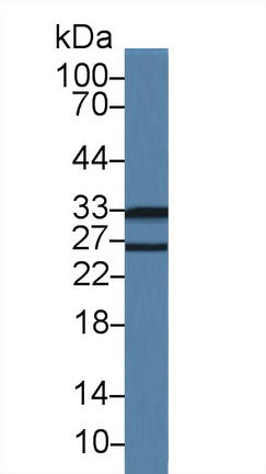 Polyclonal Antibody to Low Density Lipoprotein Receptor Adaptor Protein 1 (LDLRAP1)